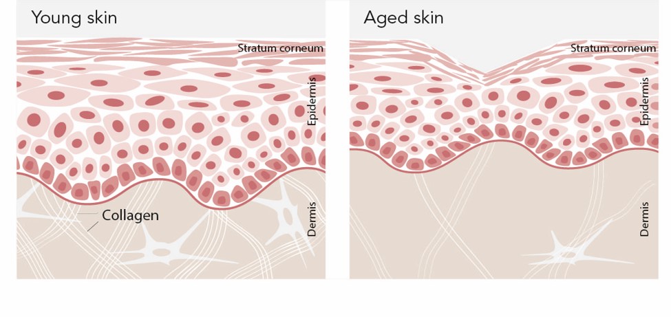 collagen aged skin